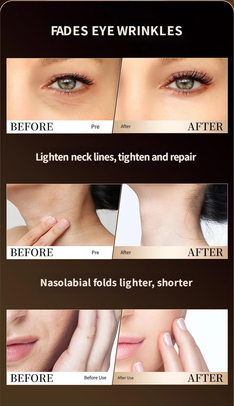 Multi Mode Facial Massager Skin Rejuvenation Anti Aging - Premium Selection Official Imagery - 6