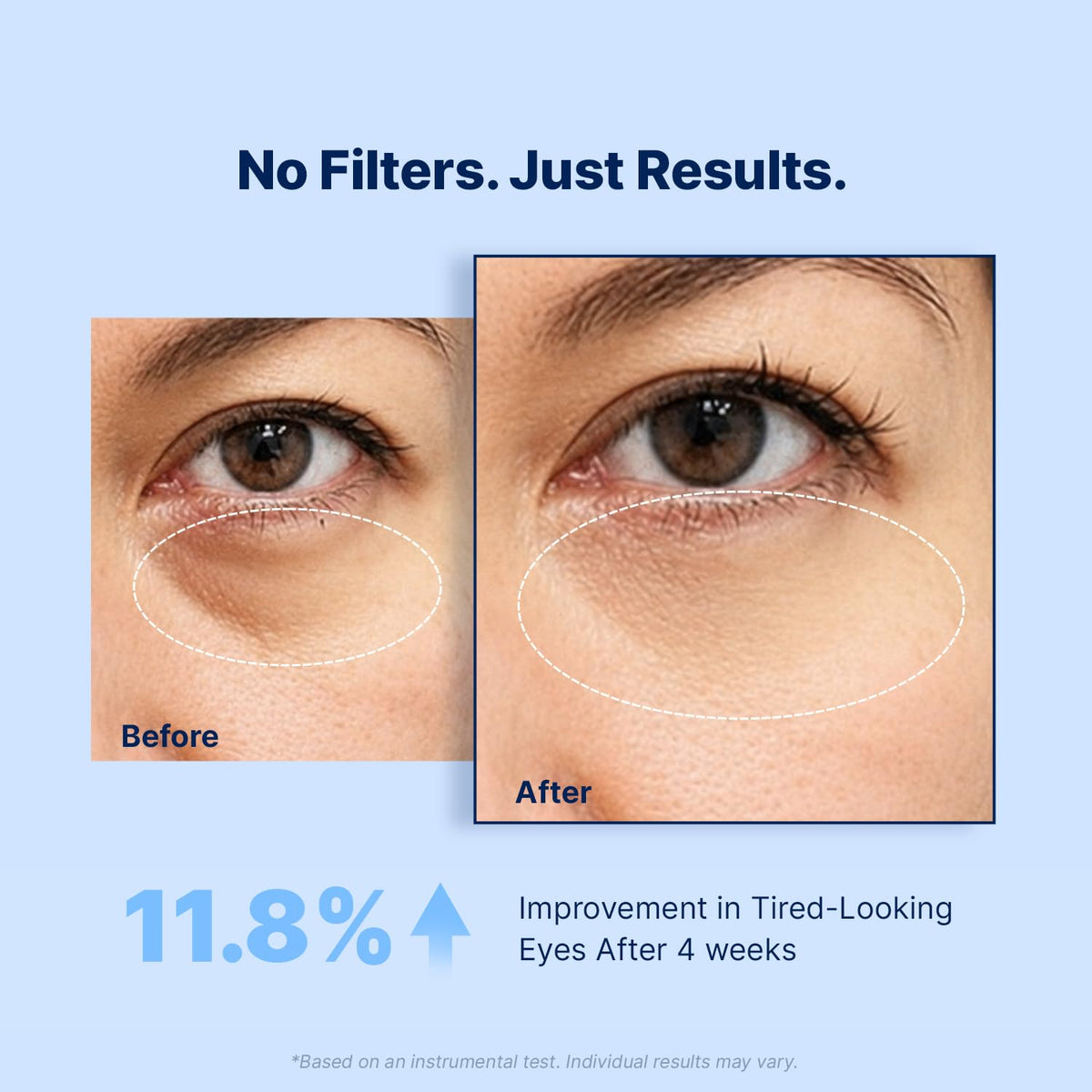 Enaskin Naturals Under Eye Patches for Puffy Eyes Dark – full view