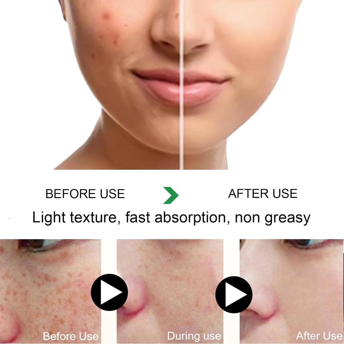 Melanina Anti Melasma Dark Kit Anti Melasma Serum Collagen - NEWUREHO Official Imagery - 4