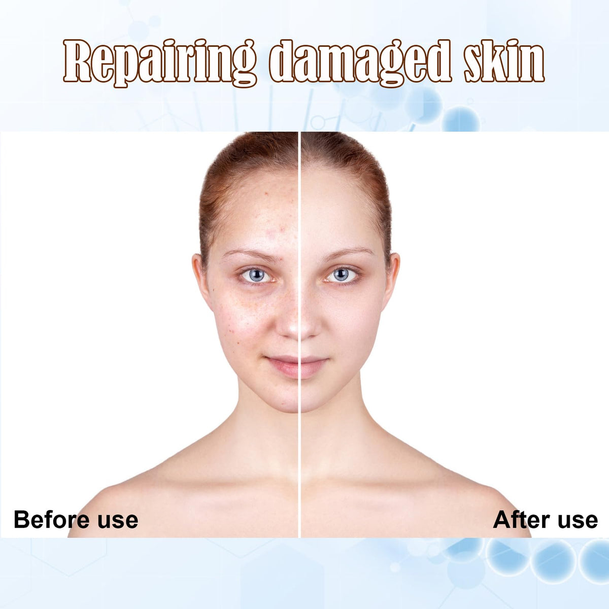 Facial Glow Starter Kit AC Stem Cell Gold Ampoule - TRESSON Official Imagery - 4