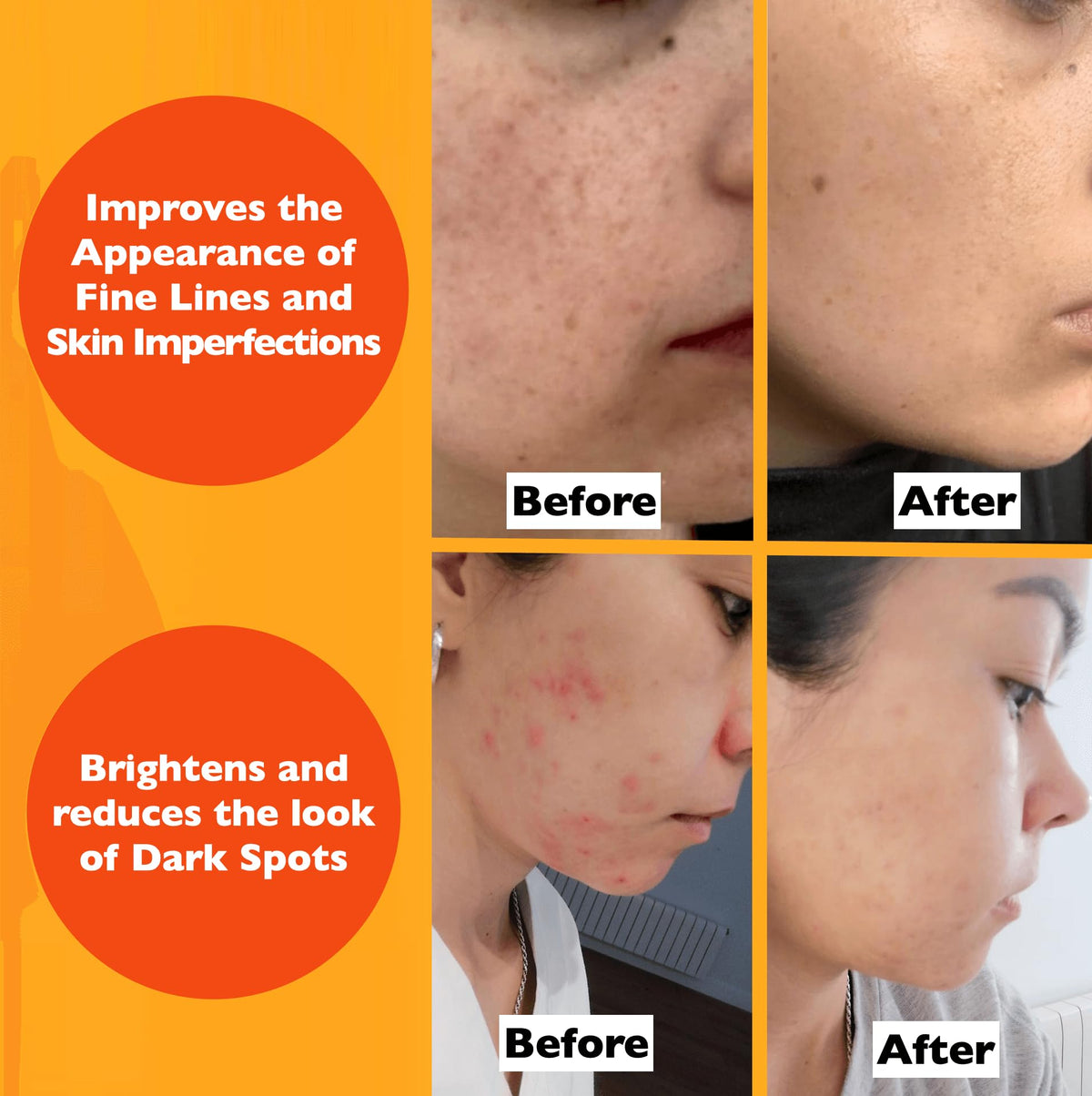 Florence Vitamin C Serum For Face Anti Aging Face Serum with Vitamin – back view and specifications
