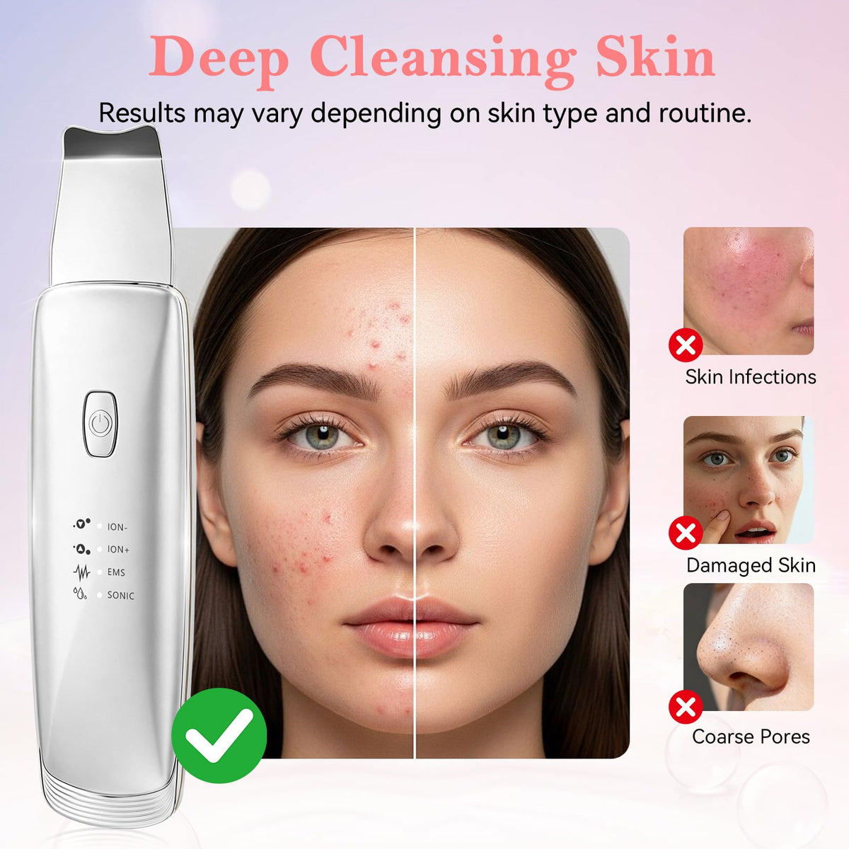 Blackhead Remover Tools 4 in 1 Skin Scrubber Face Spatula - Virviuandy Official Imagery - 7