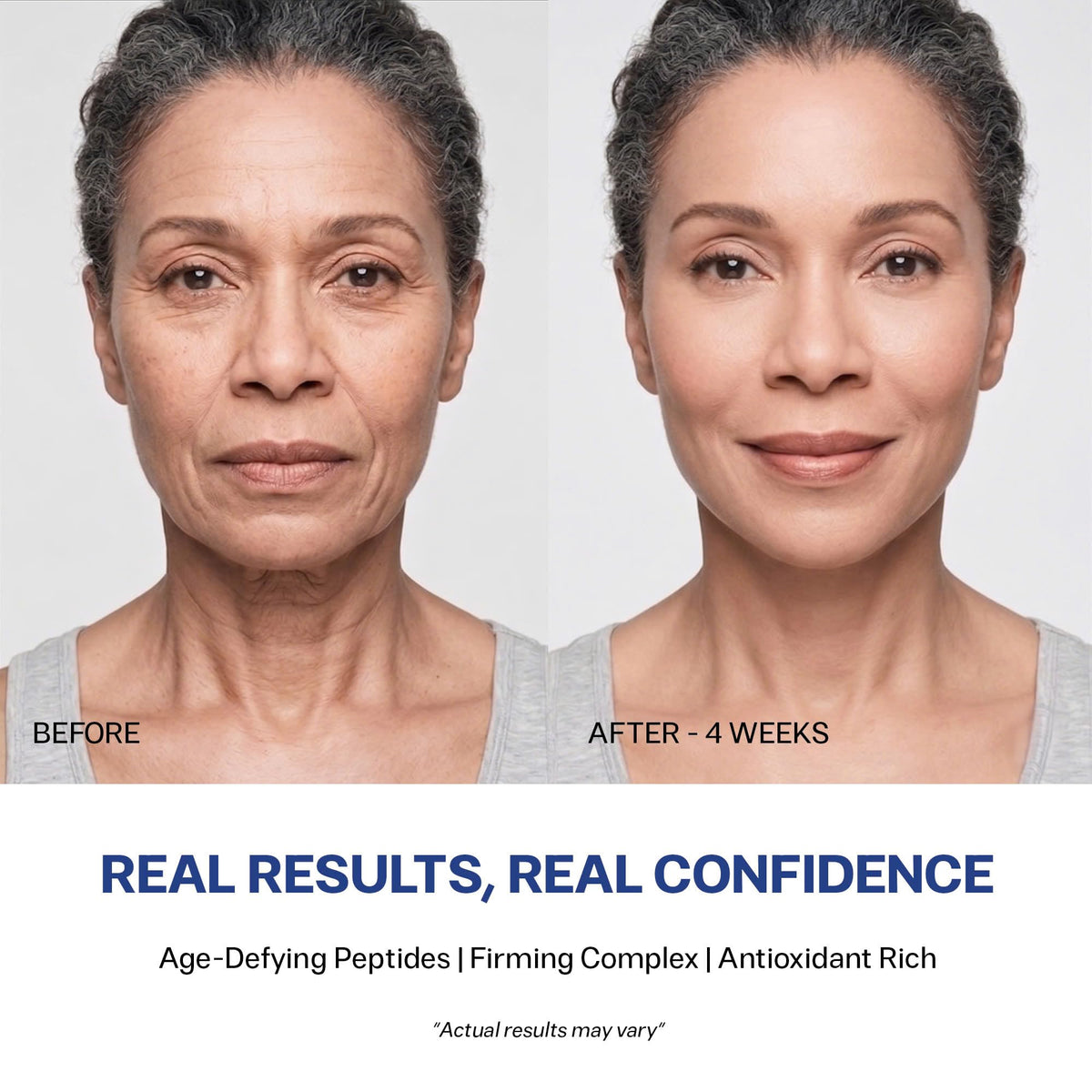 Progeline Cream Age Defying Lifting Firming Face Cream 1 8 - OBOGEE Official Imagery - 7