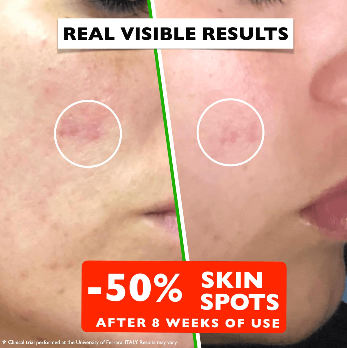 Florence Vitamin C Serum For Face Anti Aging Face Serum with Vitamin – full view
