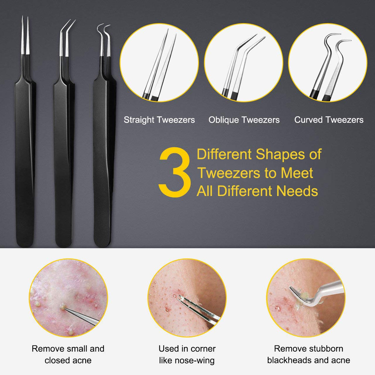 Boxoyx Pimple Popper Tool Kit – full view
