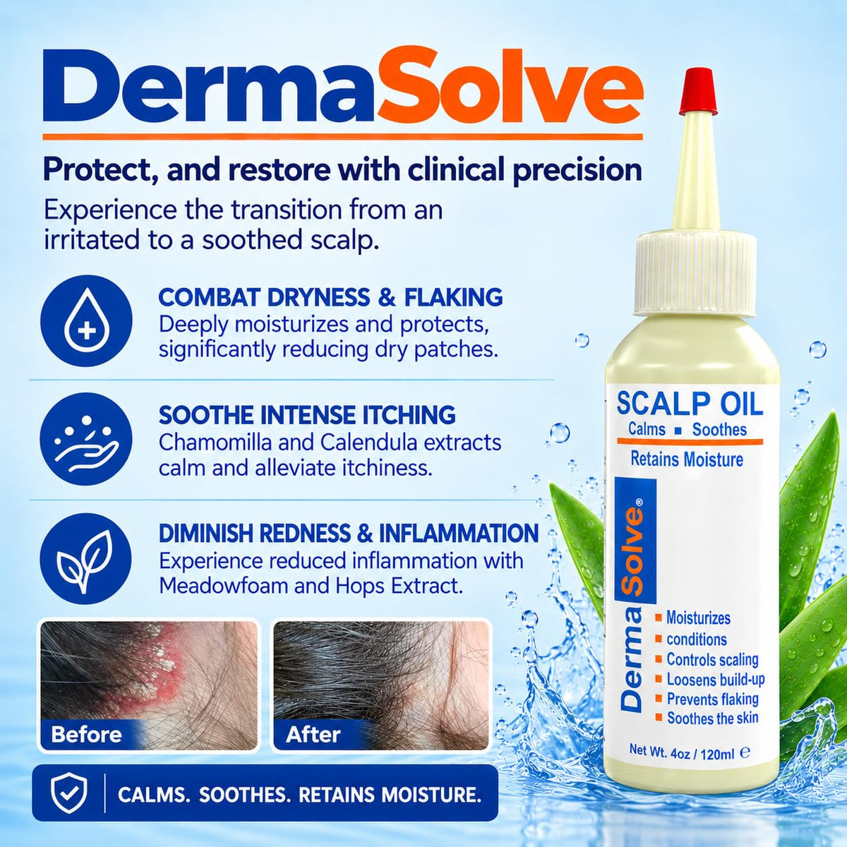 Dermasolve 4oz Psoriasis Scalp Oil Dandruff Relief - Dermasolve Official Imagery - 4