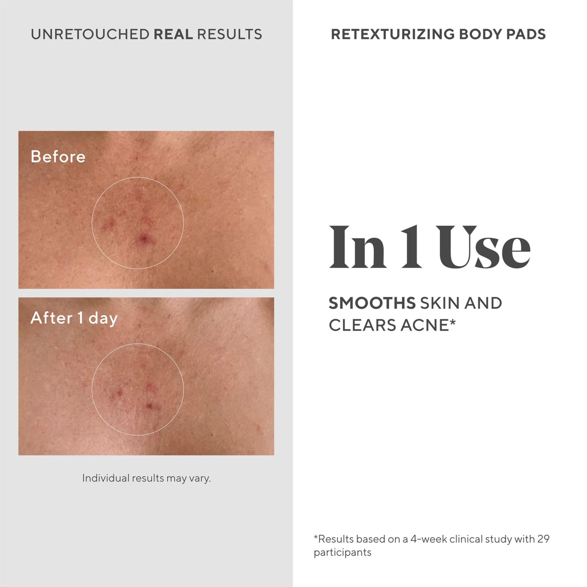 Murad Retexturizing Body Pads - Premium Selection Official Imagery - 4