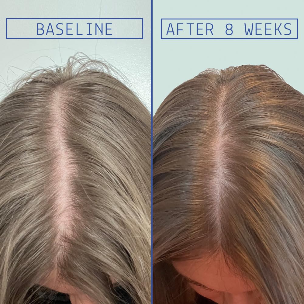 AAVRANI Hair Density Boosting Treatment 2 fl oz - AAVRANI Official Imagery - 3