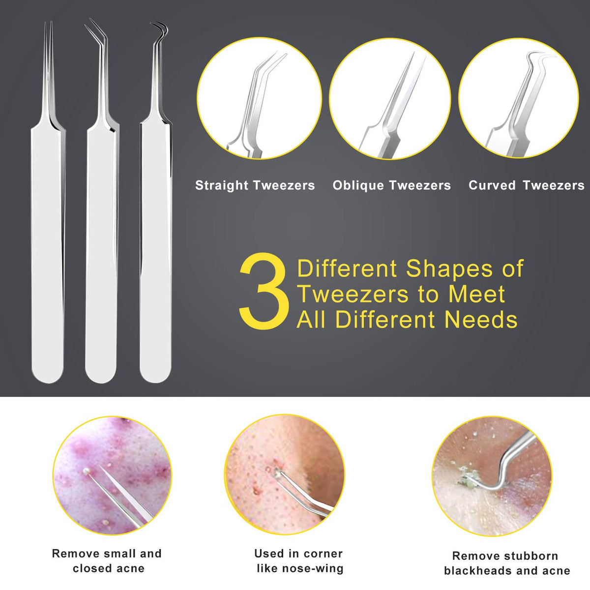 Boxoyx Pimple Popper Tool Kit – full view