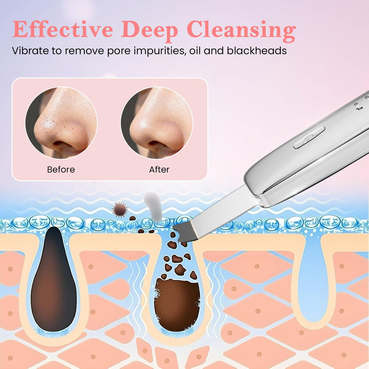 Blackhead Remover Tools 4 in 1 Skin Scrubber Face Spatula - Virviuandy Official Imagery - 4