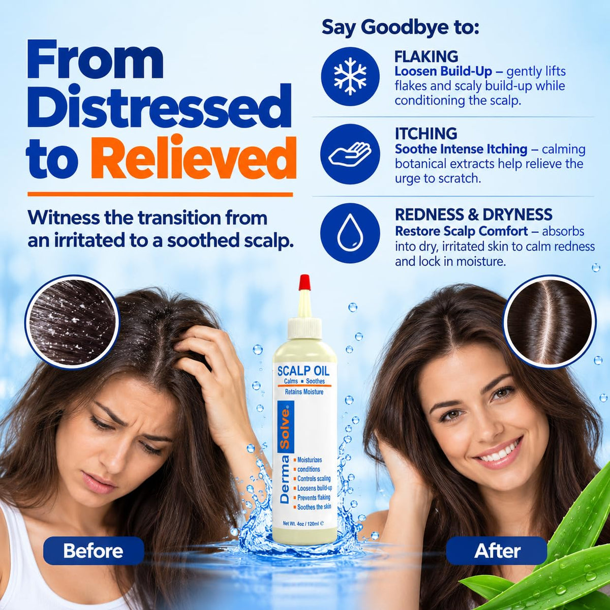 Dermasolve 4oz Psoriasis Scalp Oil Dandruff Relief - Dermasolve Official Imagery - 3