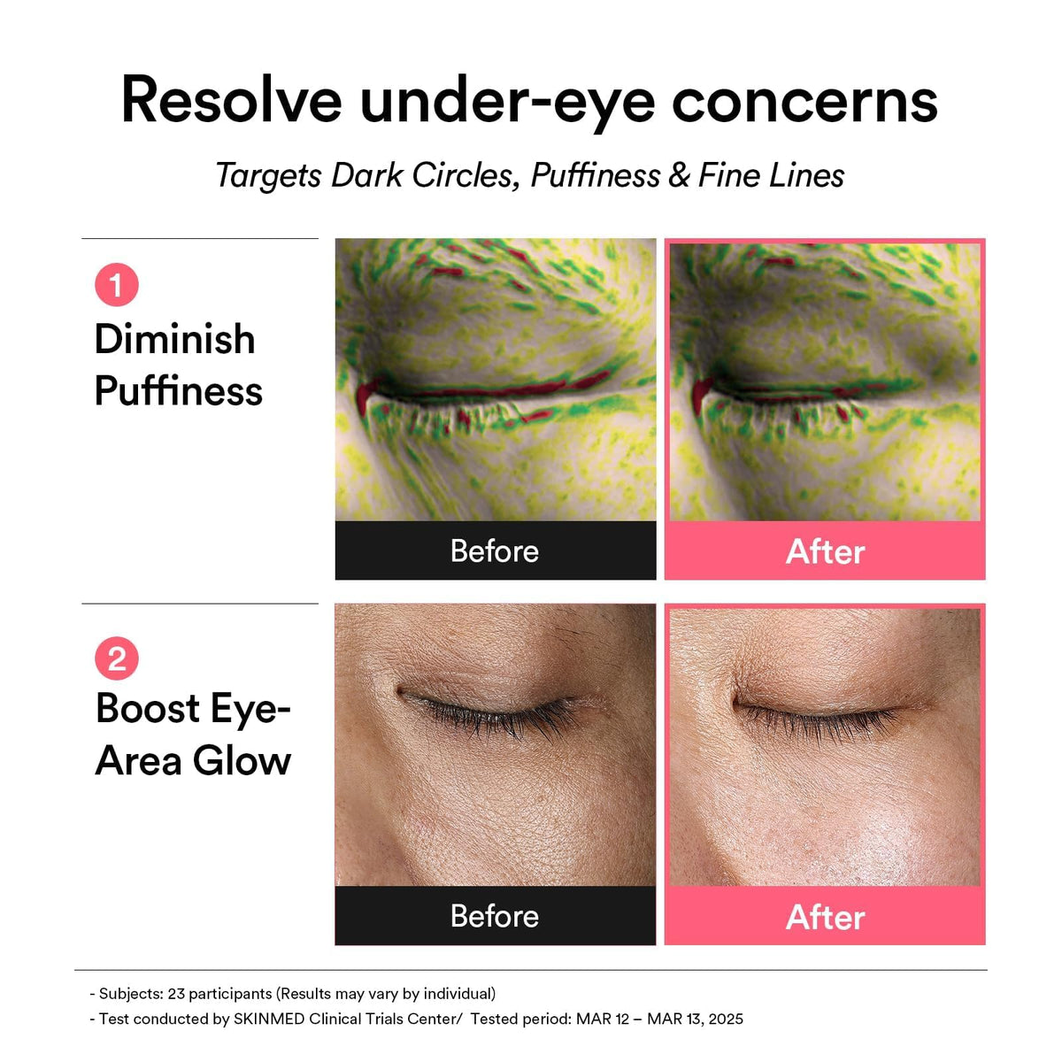 Abib PDRN Retinal Eye Patches for Rejuvenating Puffy Eyes – back view and specifications
