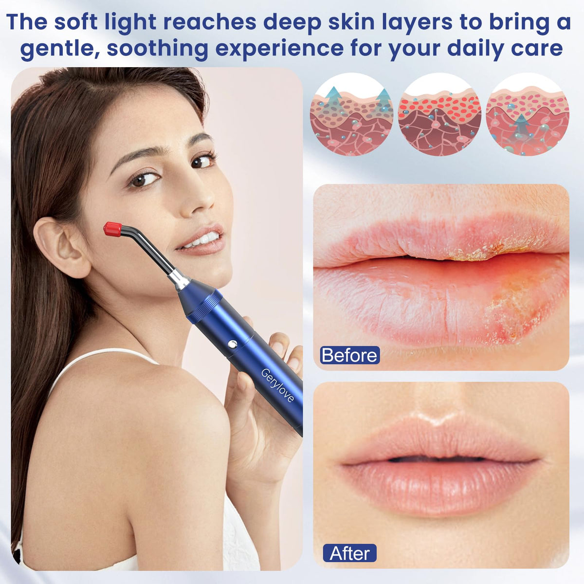 Red Light Therapy Wand Rechargeable Portable Red Infrared - GERYLOVE CARE Official Imagery - 7