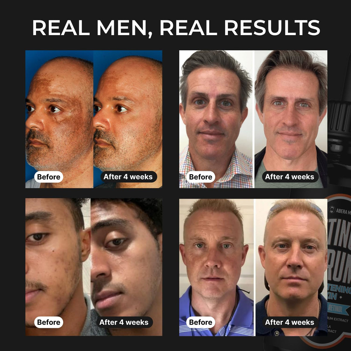 Abera Men Retinol Serum Reduces Dark Spots Melasma Wrinkle - ABERA Official Imagery - 5