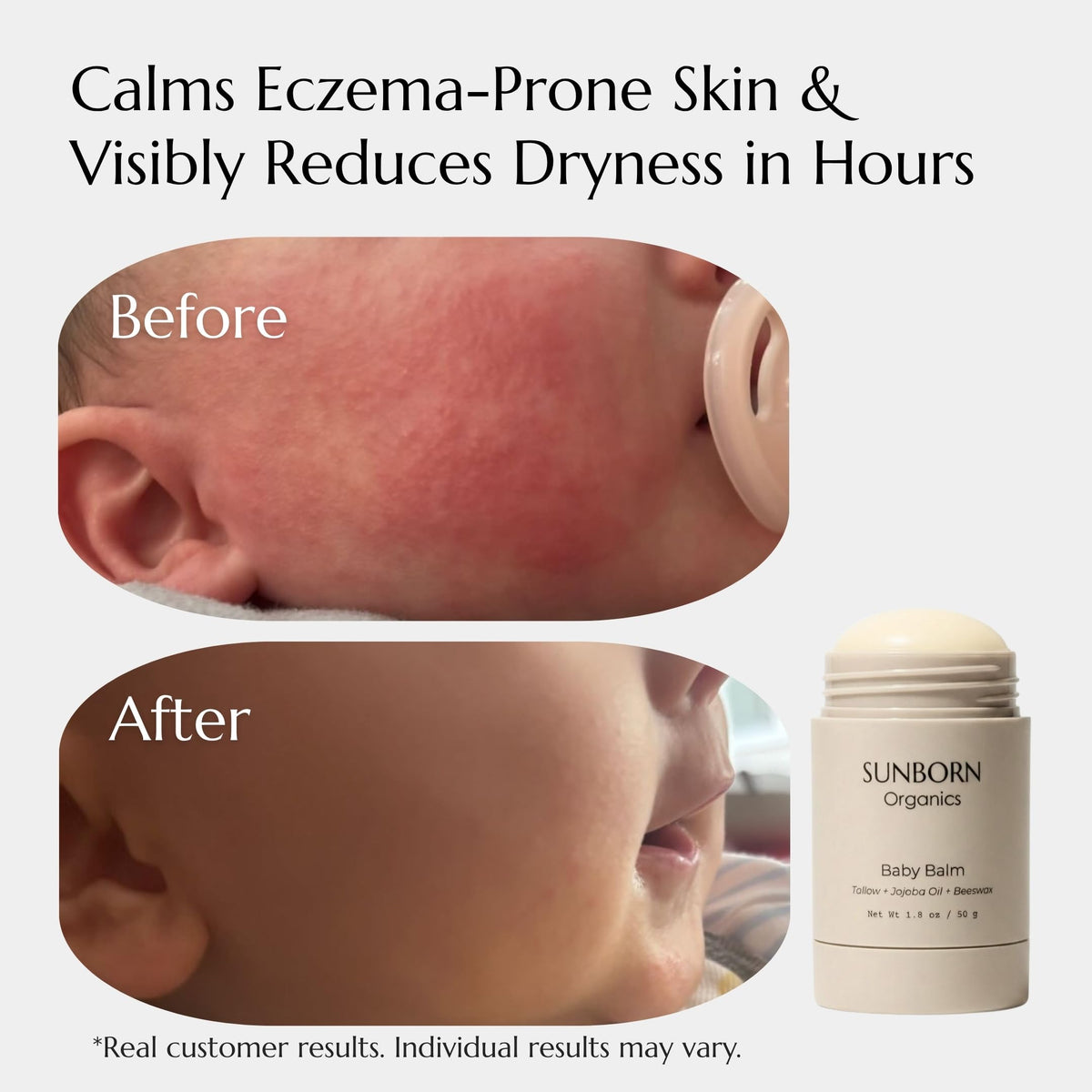 Baby Balm - Sunborn Organics Official Imagery - 4