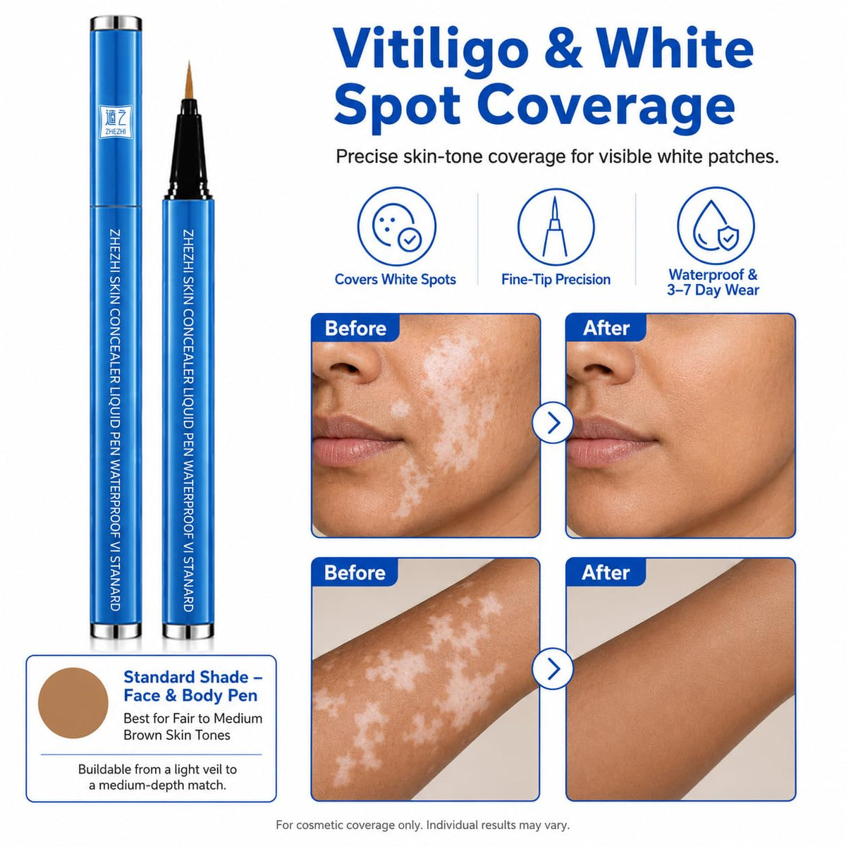 Vitiligo Concealer Pen 3 5g Waterproof 3 7 Days Face Body - ZHEZHI Official Imagery - 5