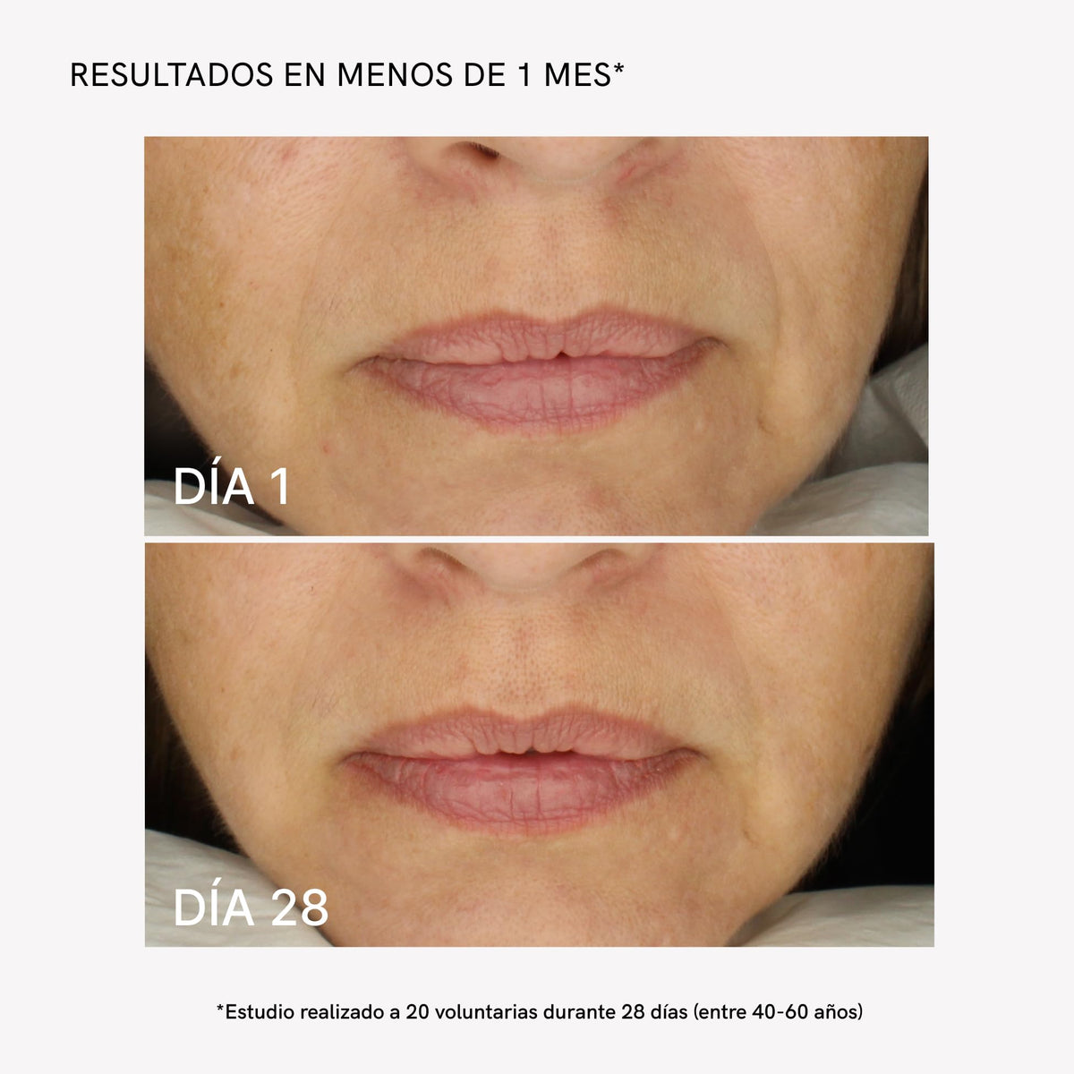MASDERM - MASDERM Official Imagery - 4