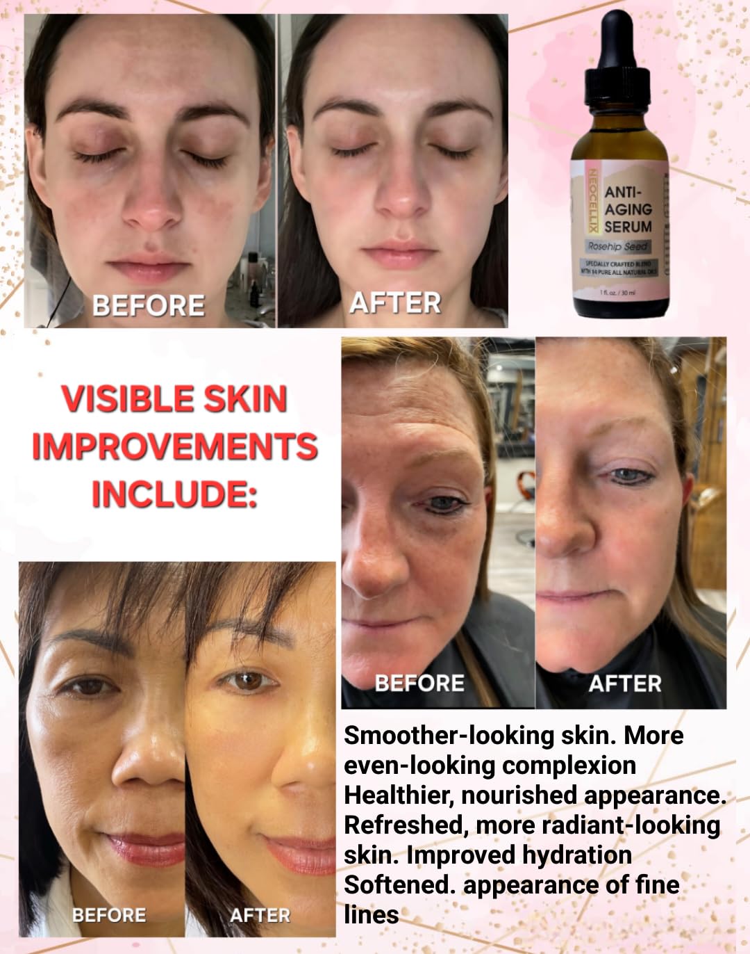 Anti Aging Oil Serum Made From 14 Pure All Natural Oils - Neogentek Official Imagery - 7