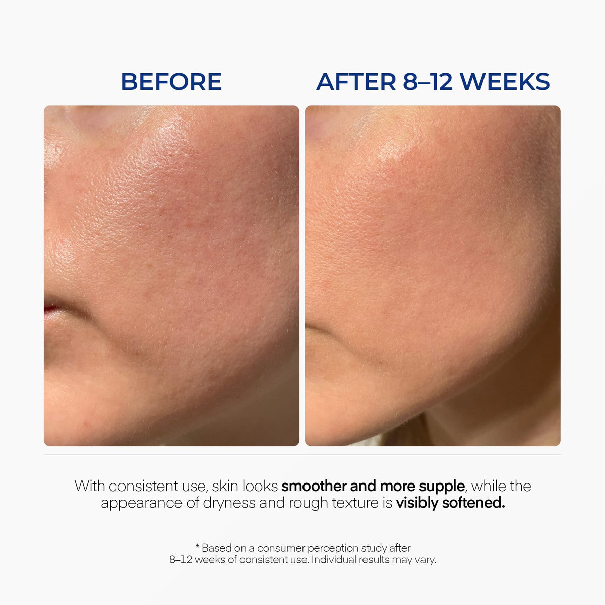 Lanmeri Triple Lipid Peptide Cream Rich Face Moisturizer - Lanmeri Official Imagery - 6