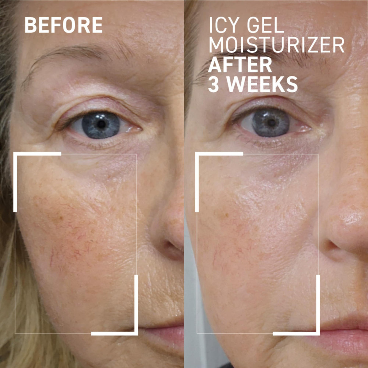 Dr Brandt iD STRESS Icy Gel Moisturizer - Dr. Brandt Skincare Official Imagery - 3