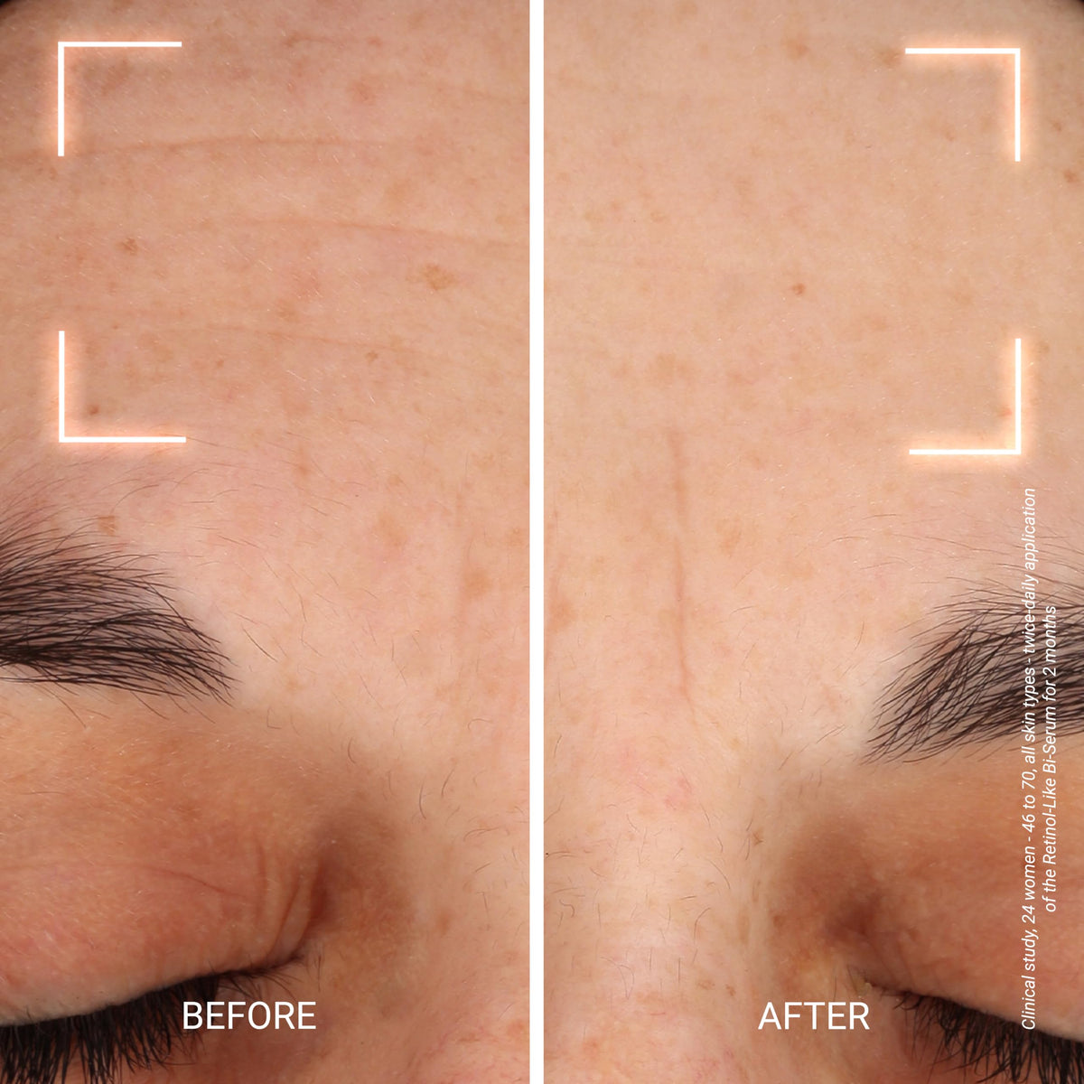 YonKa Paris Advanced Retinol Alternative Bi Serum - Yonka Official Imagery - 4