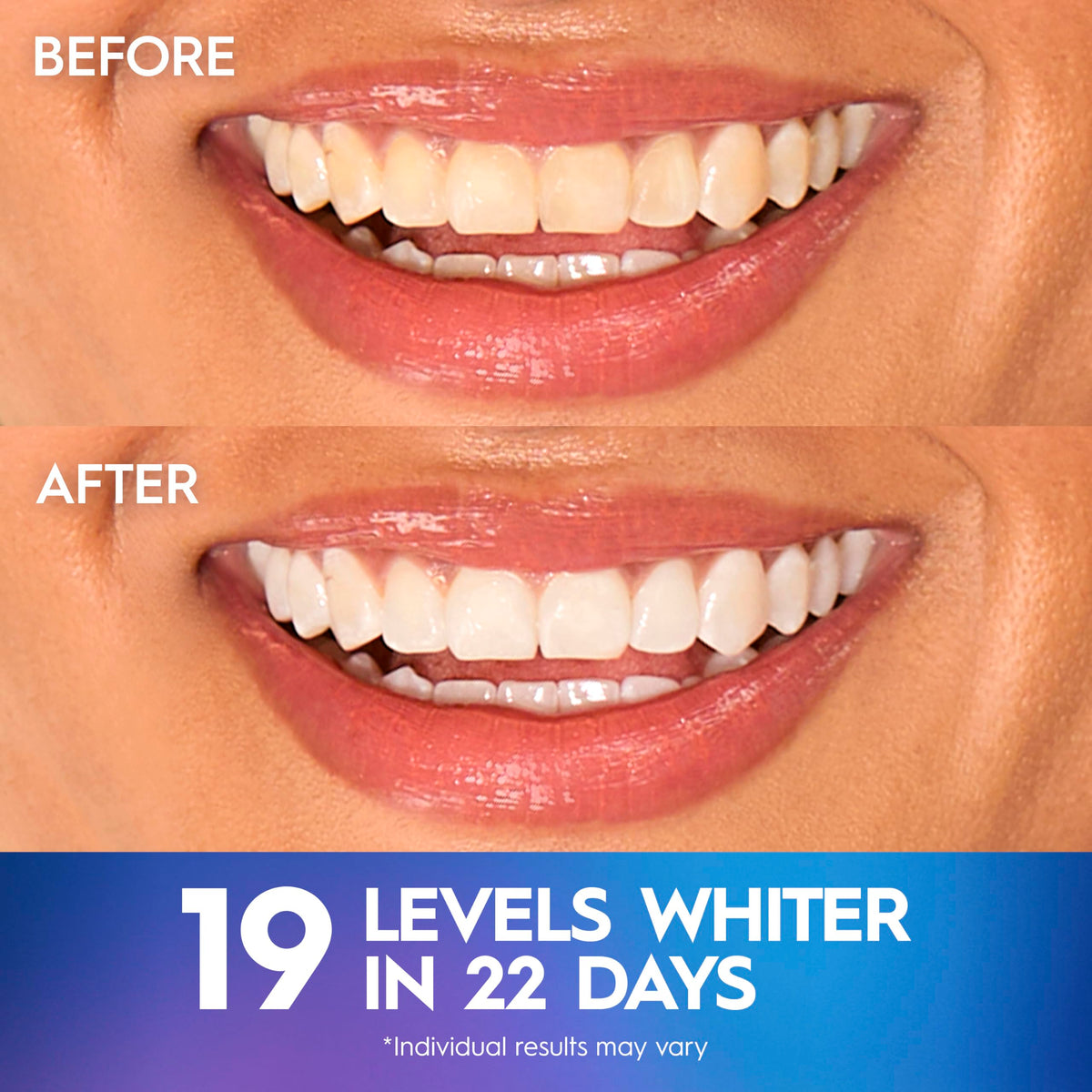 Crest Teeth Whitening Strips Crest 3D Whitestrips - Crest Official Imagery - 5