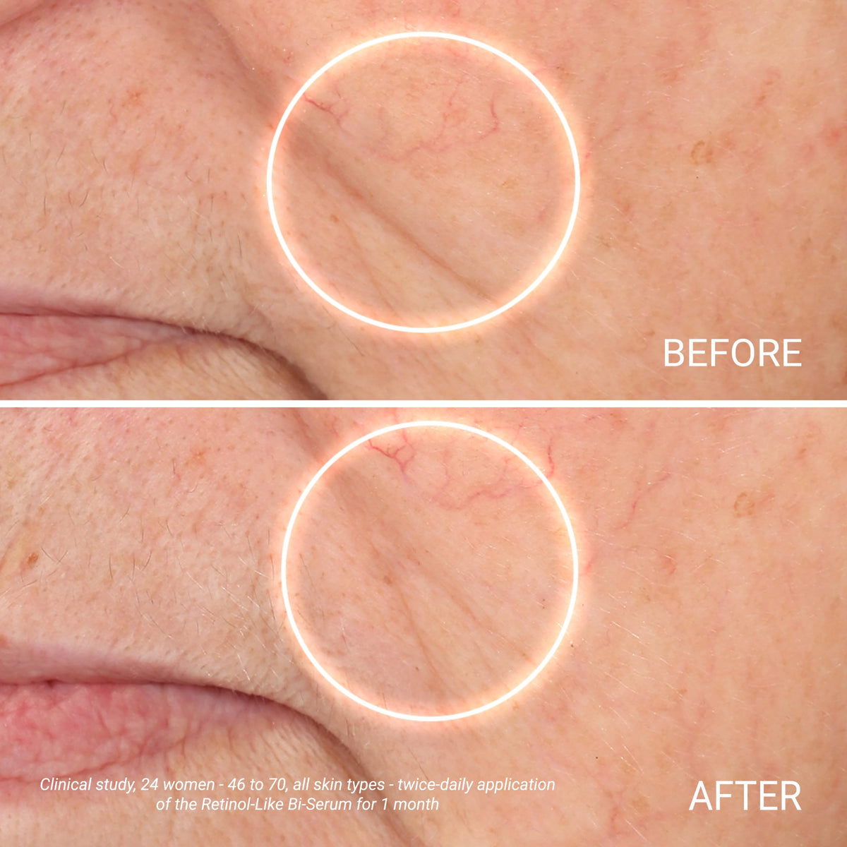 YonKa Paris Advanced Retinol Alternative Bi Serum - Yonka Official Imagery - 6