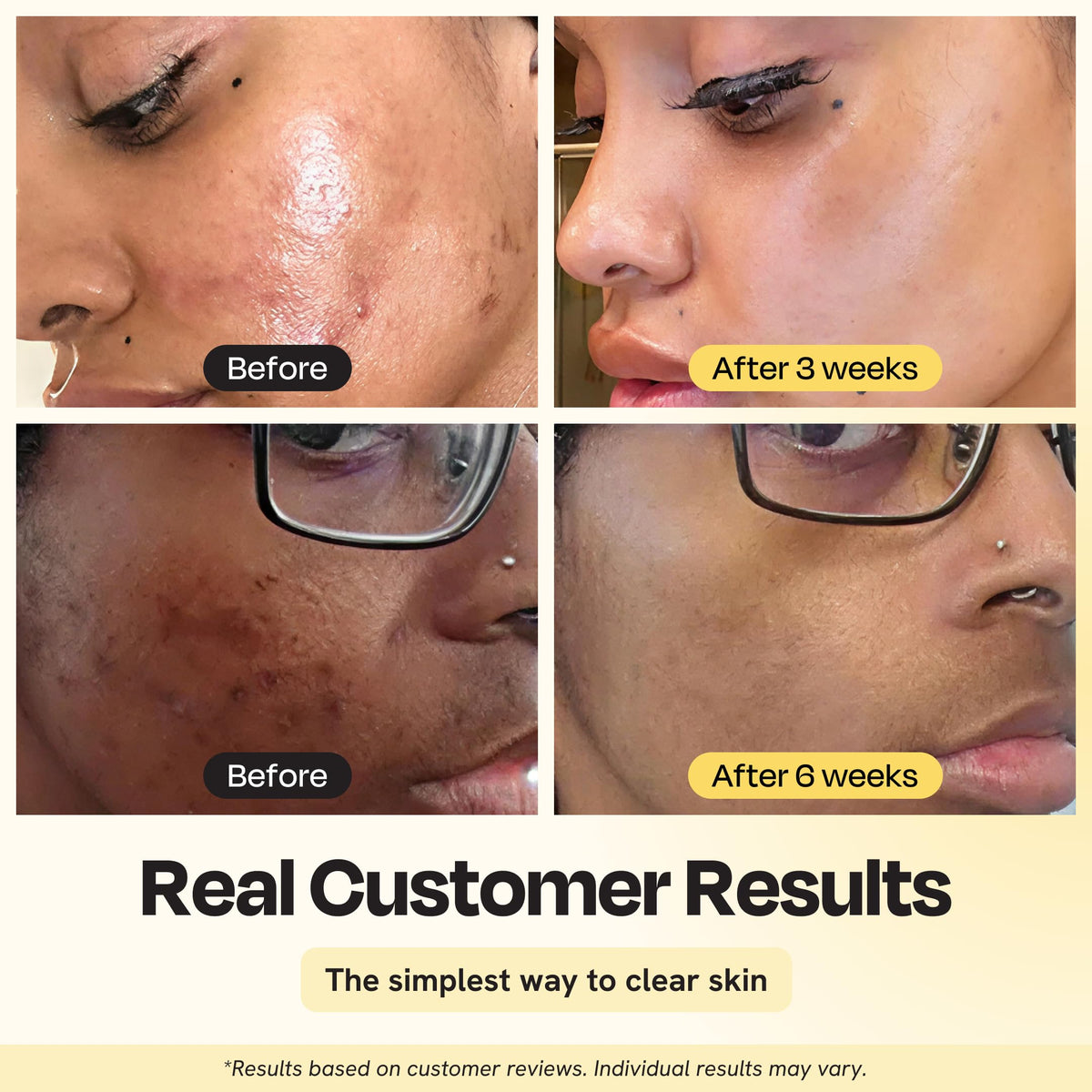 Gleamin Vitamin C Clay Mask for Dark Spots 2 5oz Brightening - Gleamin Official Imagery - 3