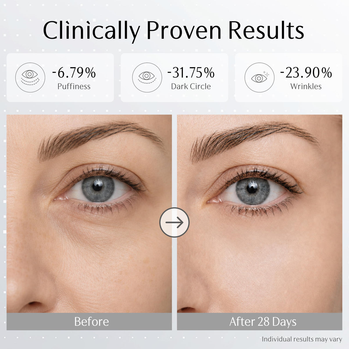 PDRN EMS Eye Cream Dark Circle Vibrating Exosome Anti Aging - GUYU Official Imagery - 7