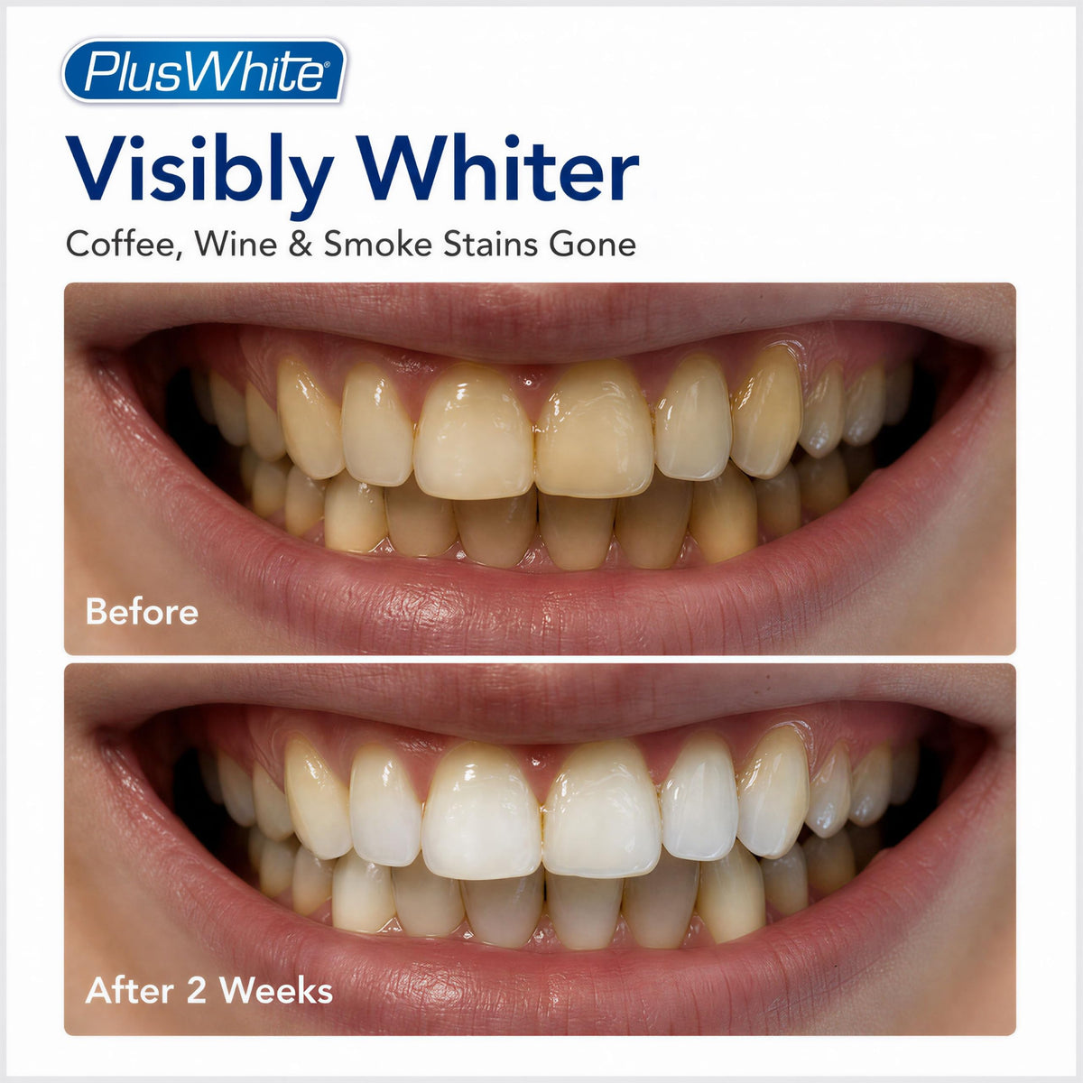 Plus White Speed Whitening Gel 5 MinuteTeeth Whitening – packaging and label
