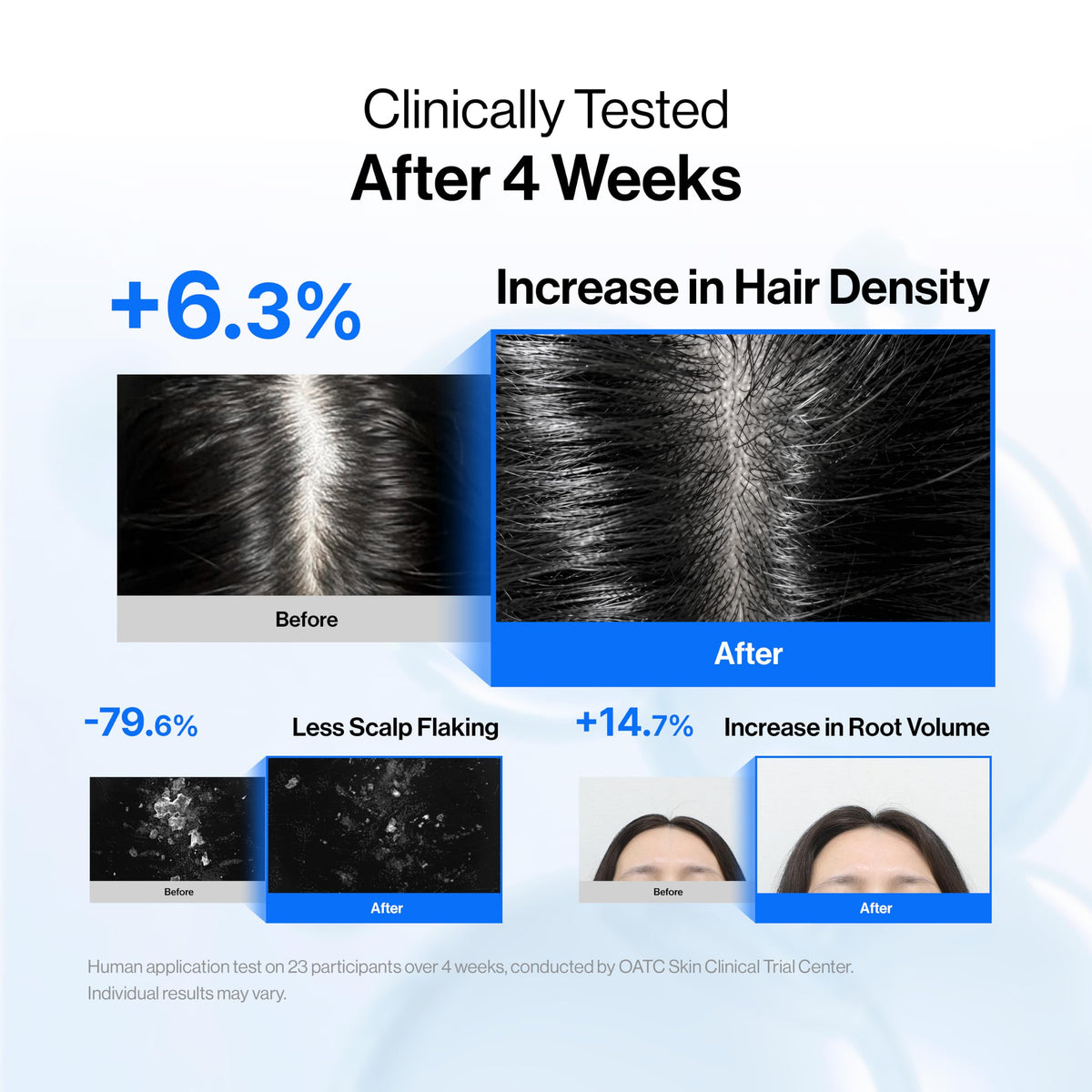 Refilled Hair Lash Growth Set - Refilled Official Imagery - 4