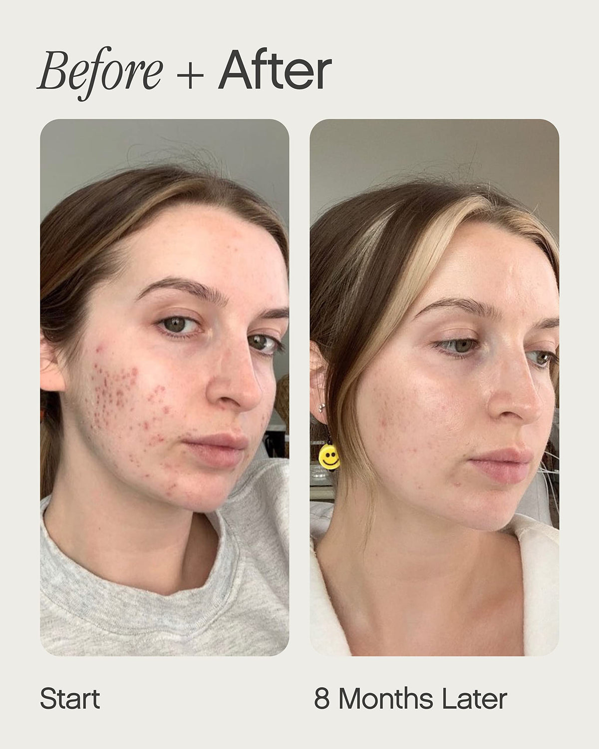 Topicals Post Acne Kit Mini Faded Serum Sealed Active Primer - Topicals Official Imagery - 3