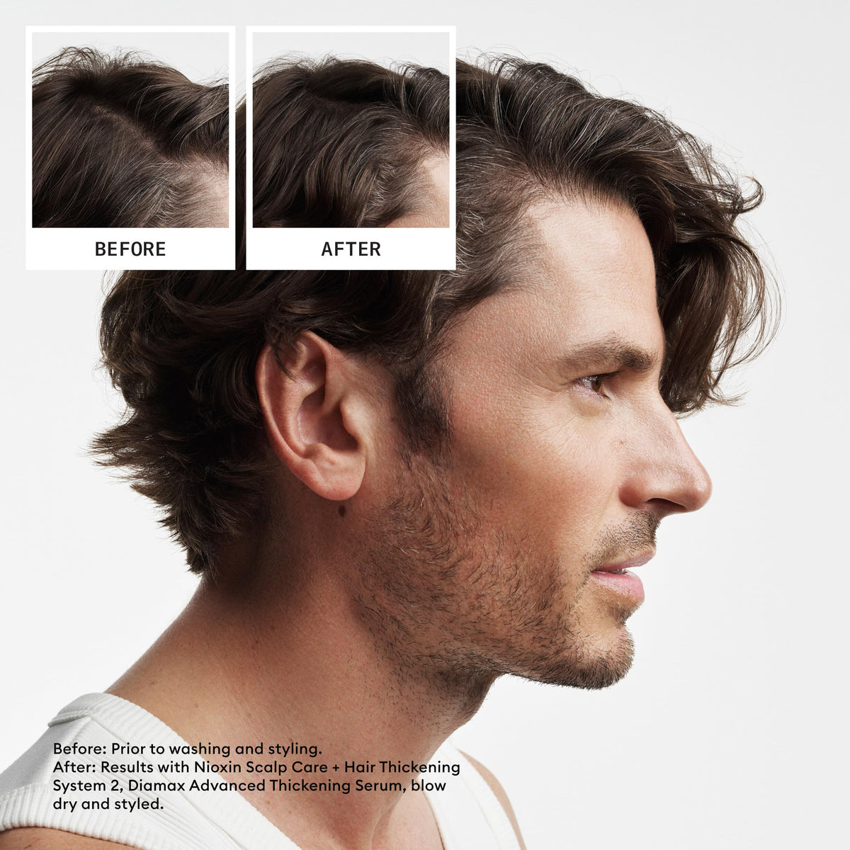 Nioxin System 2 - Premium Selection Official Imagery - 3