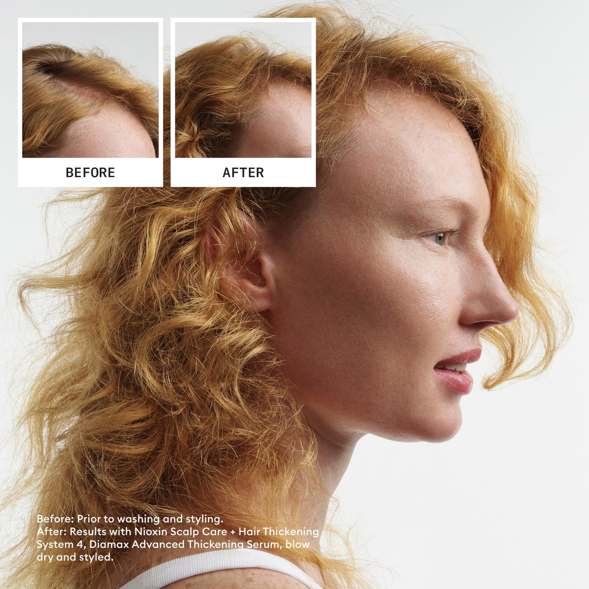 Nioxin System 4 Scalp Care Hair Thickening Leave In - Premium Selection Official Imagery - 3