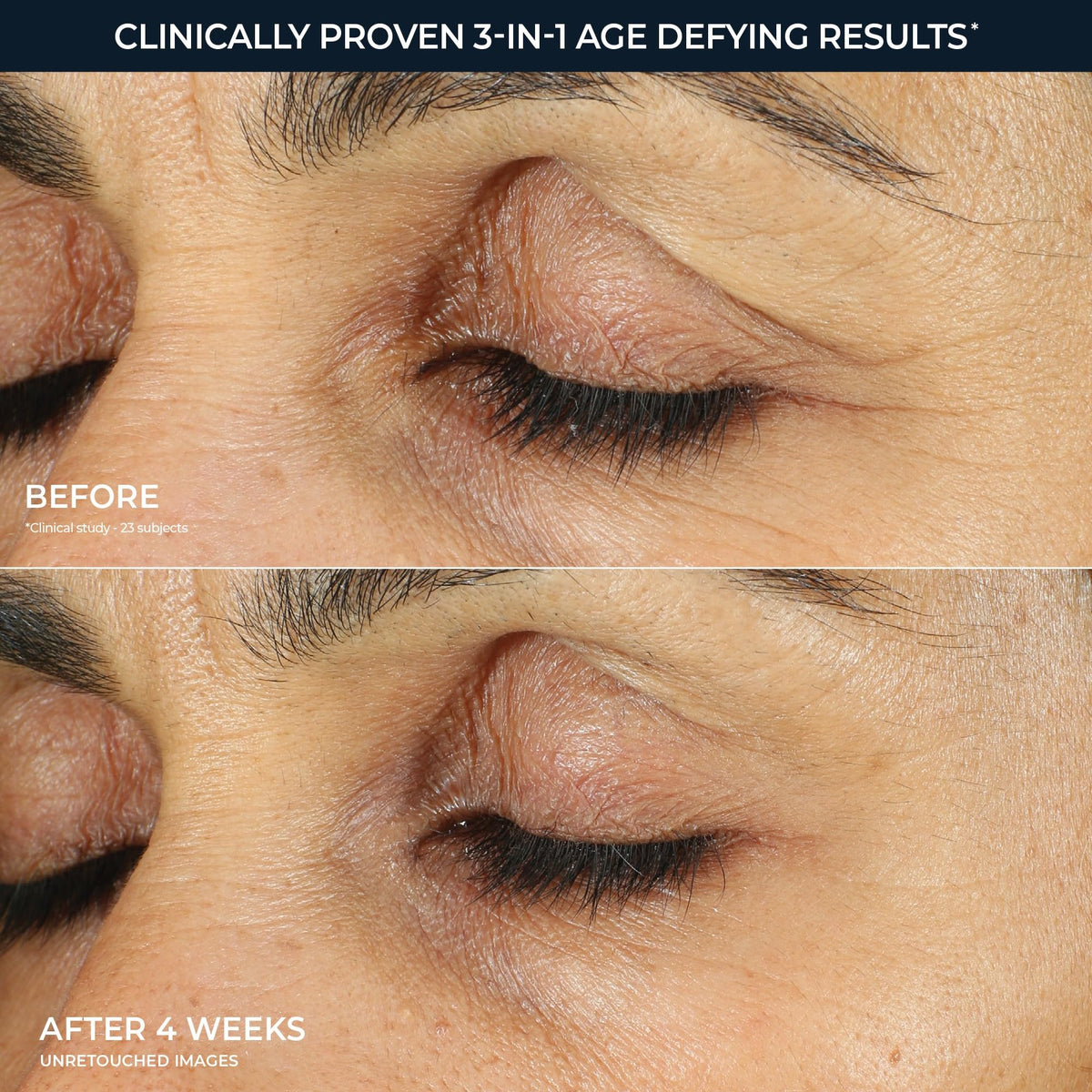 RoC Retinol Correxion Under Eye Cream for Dark Circles – full view