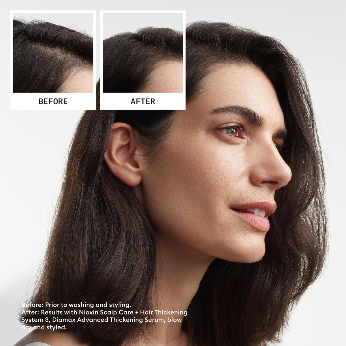 Premium Selection Nioxin System 3 – close-up detail
