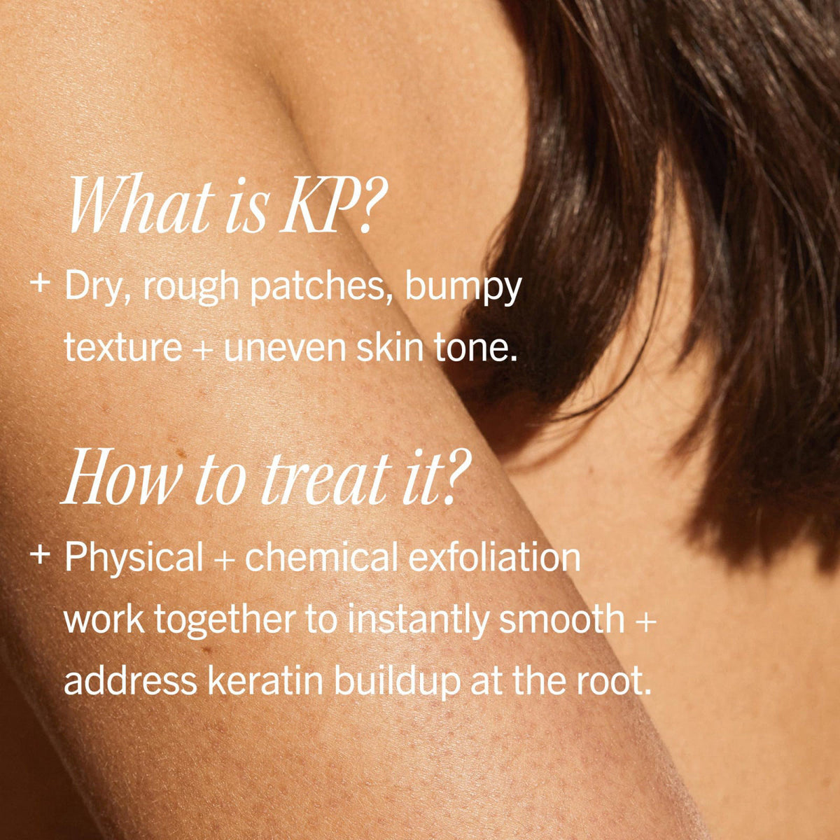 First Aid Beauty KP Bump Eraser Scrub 10 AHA Sensitive Skin by Premium Selection — view 6
