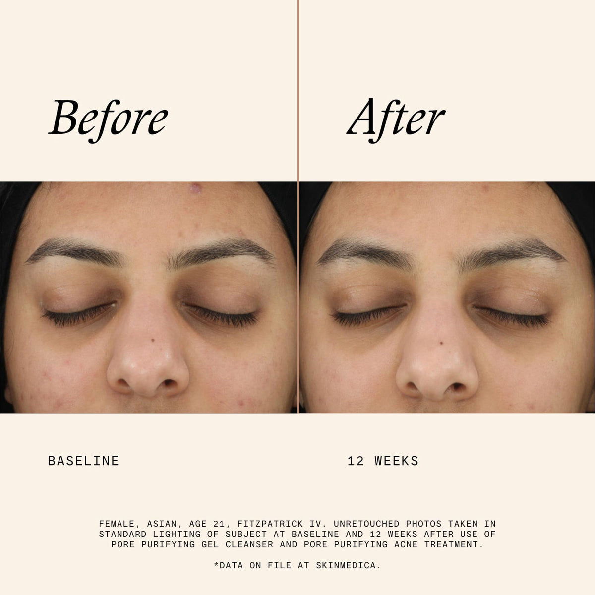 SkinMedica Pore Purifying Gel Cleanser by Premium Selection — view 5
