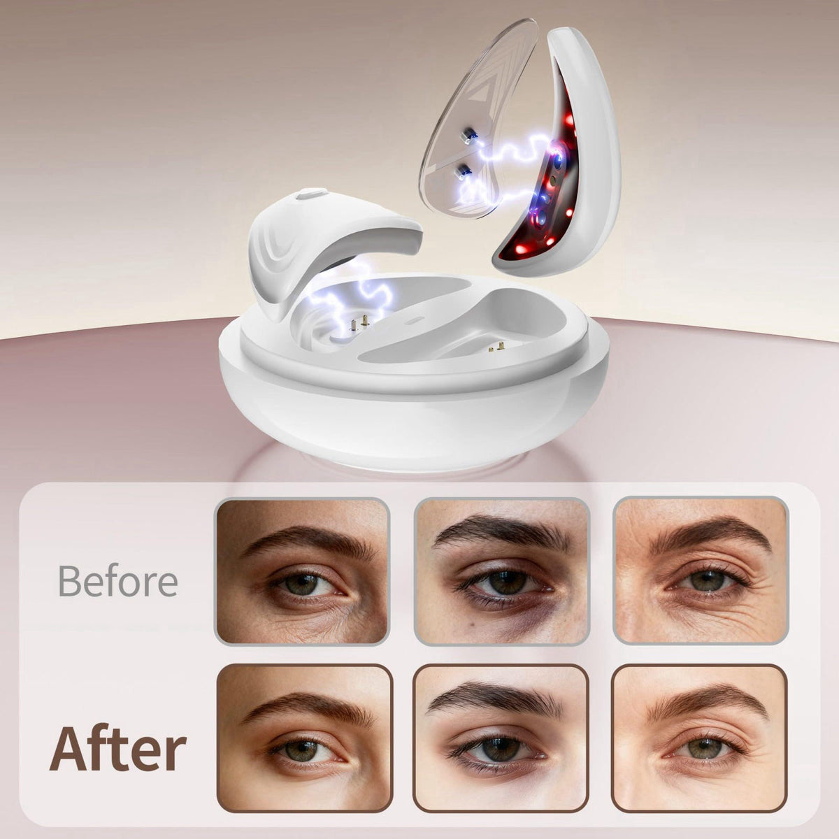 Eye Pods for Under Eyes Bags Portable Red Light Therapy Eyes by OGGRXOR — view 6