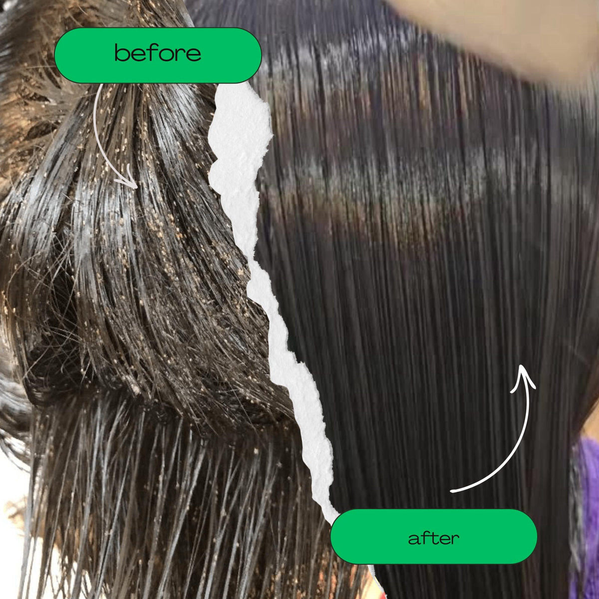 My Hair Helpers Lice Eliminator Comb by MY HAIR HELPERS NATURAL LICE REMOVAL — view 4