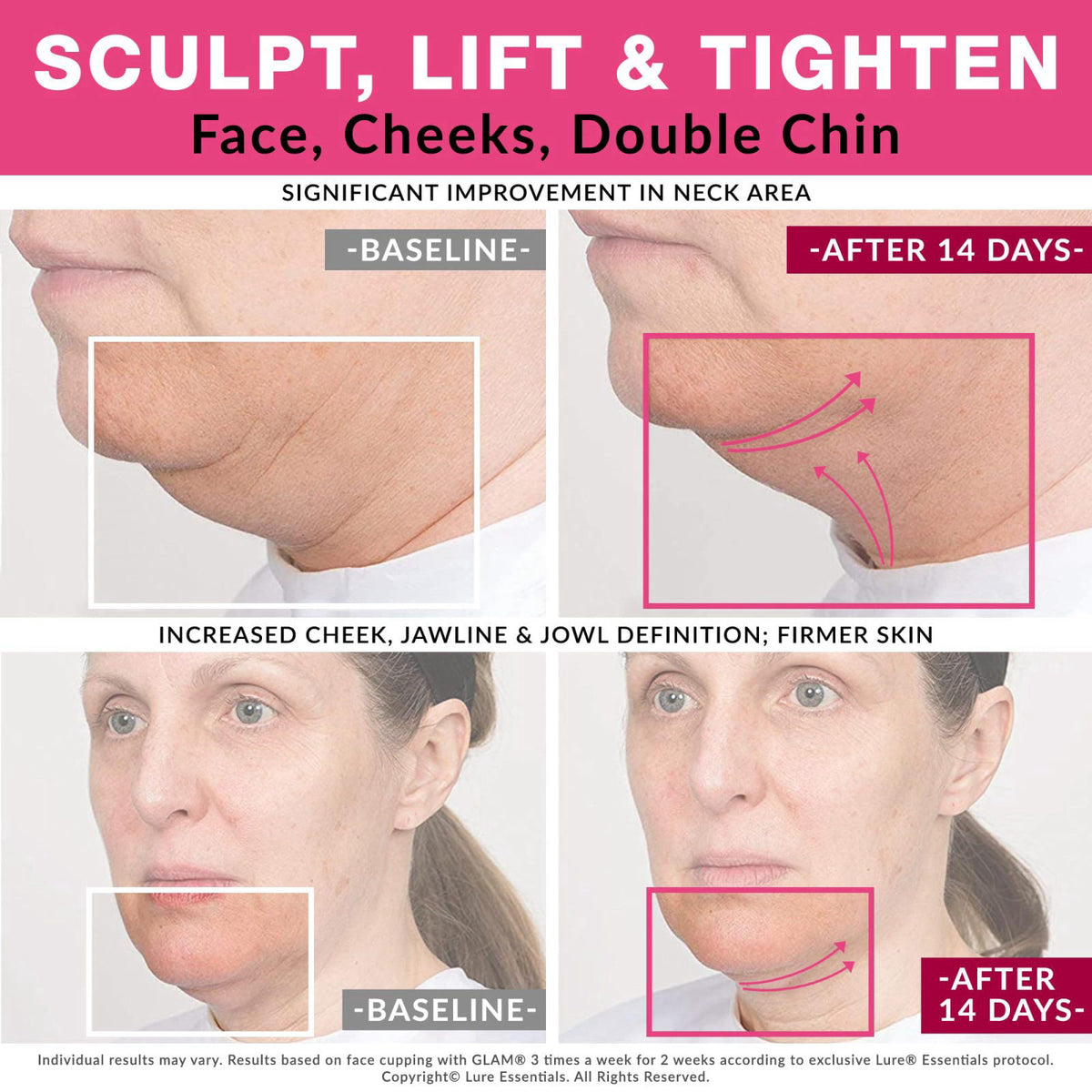 Glam Facial Face Cupping Set Cupping Therapy Sets GLAM by Lure Essentials — view 4