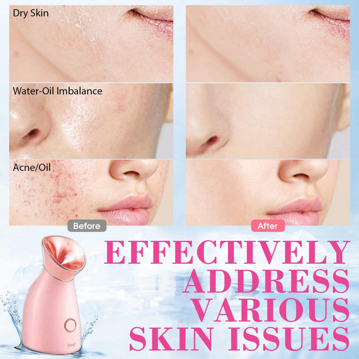 Pjordo Facial Steamer Spa Kit 12 Skin Care Tools 5 Jelly — view 8